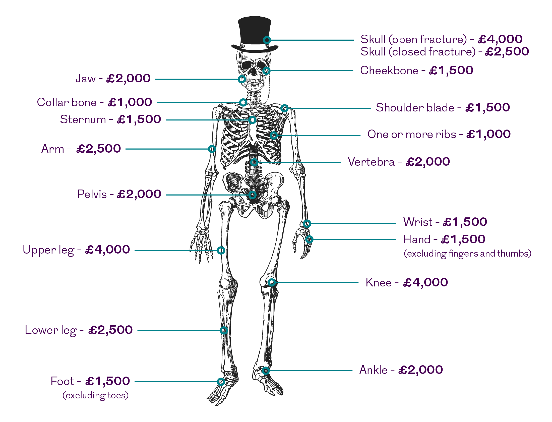 Illustration of a skeleton showing the various payments for different body fractures.